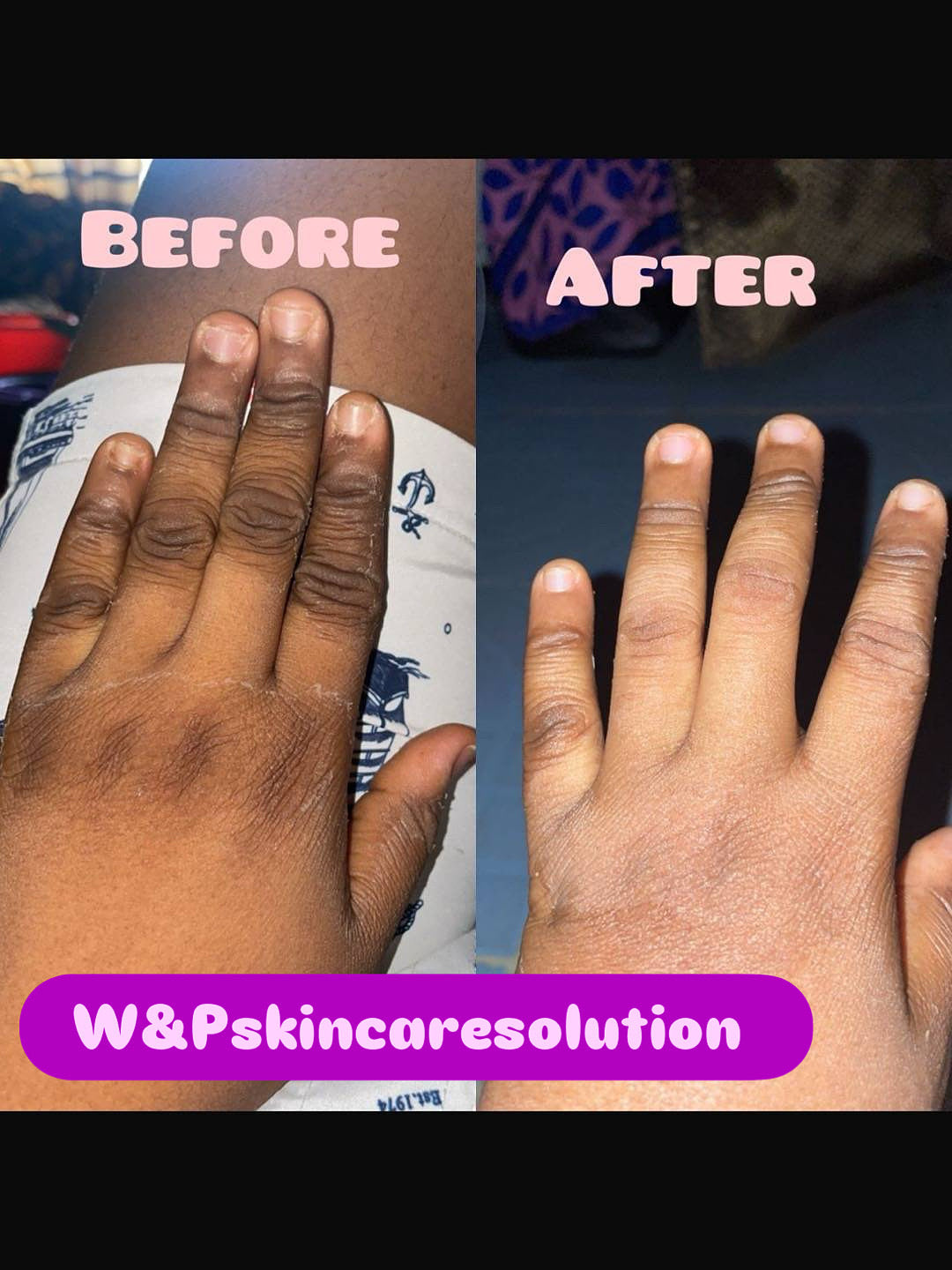W&P Dark Knuckles Cleanser