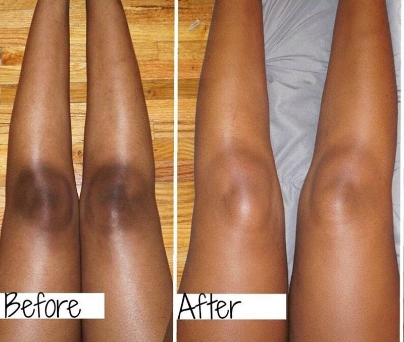 Radiant Skin Lightening cream