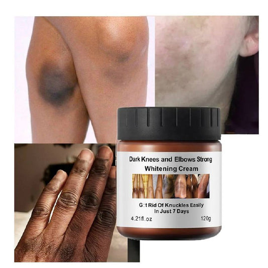 Dark Knuckle Brightening Kit \\Brightening Cream + Whitening Oil + Whitening Serum